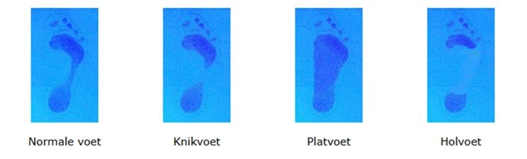 Voettypen